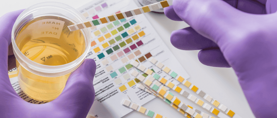 A lab tech is reviewing employment drug test results from a urine sample.